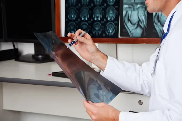 Проведение рентгеновских рентгенолога — стоковое фото